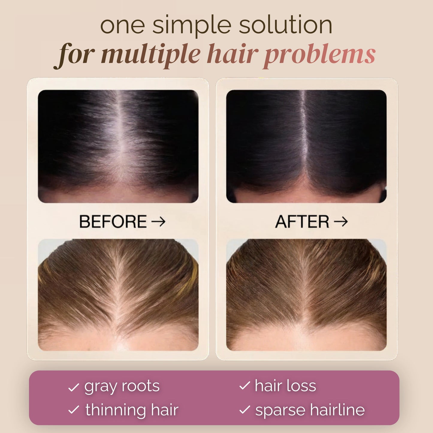 RootBlend™ Hair Concealer