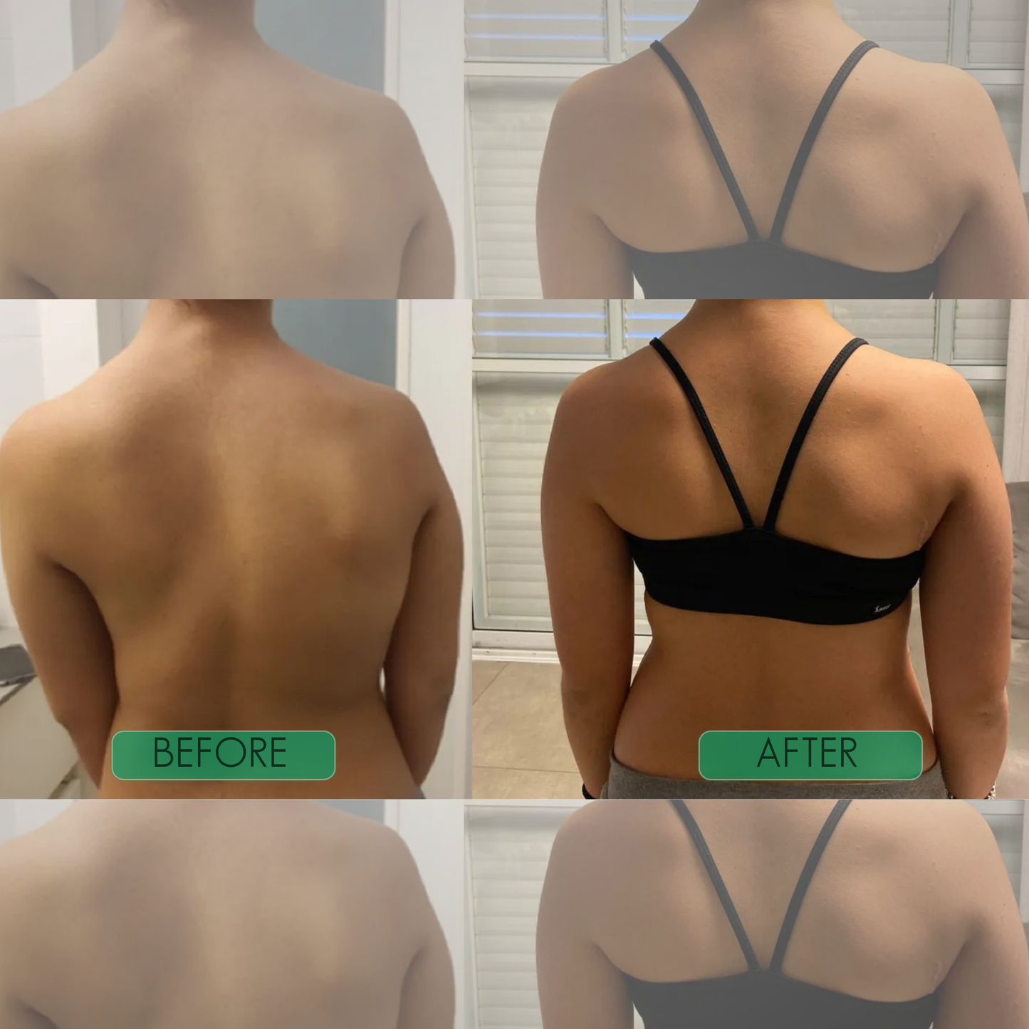 PosturePro™ Back Support Corrector