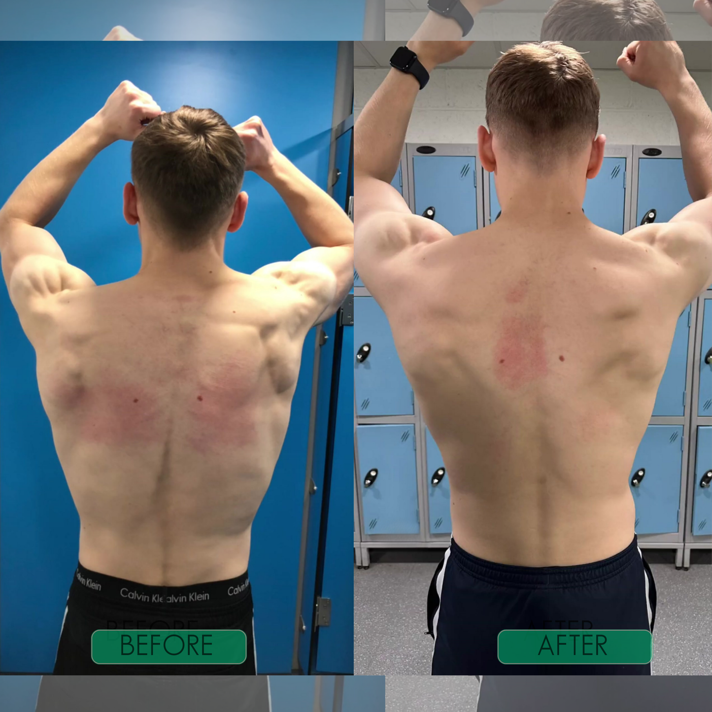 PosturePro™ Back Support Corrector