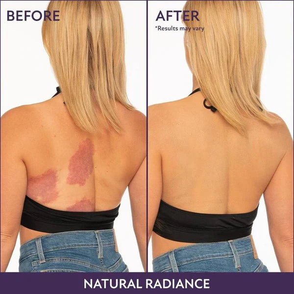 SkinPerfect™ Complexion Perfector