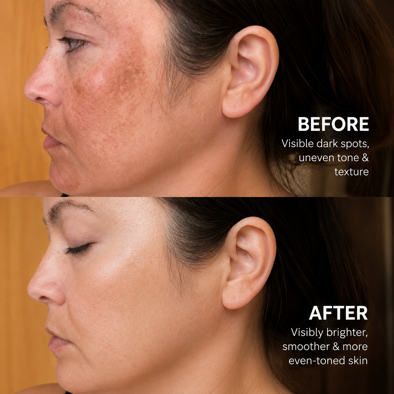 LumiClear™ Tranexamic Acid Brightening Cream