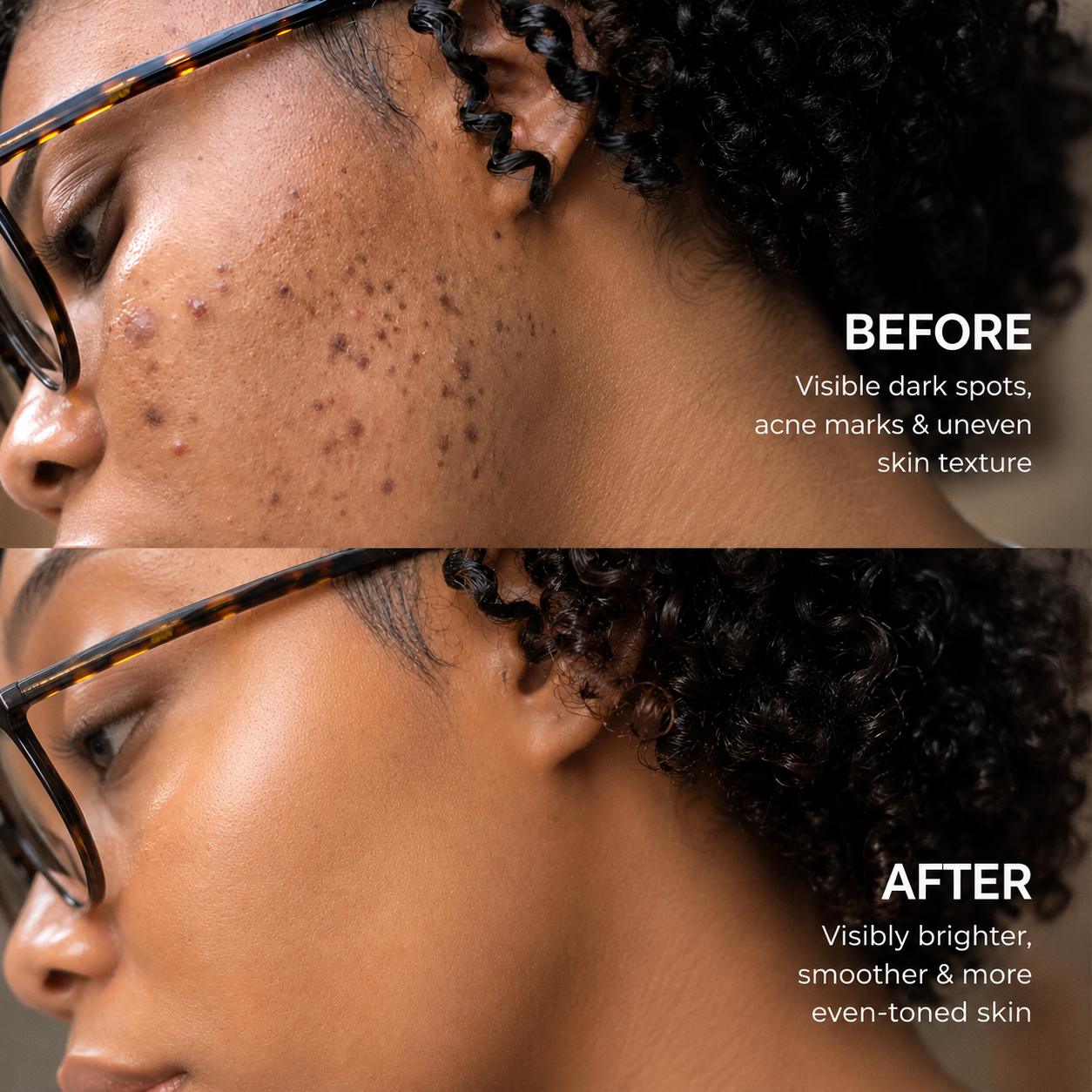 LumiClear™ Tranexamic Acid Brightening Cream
