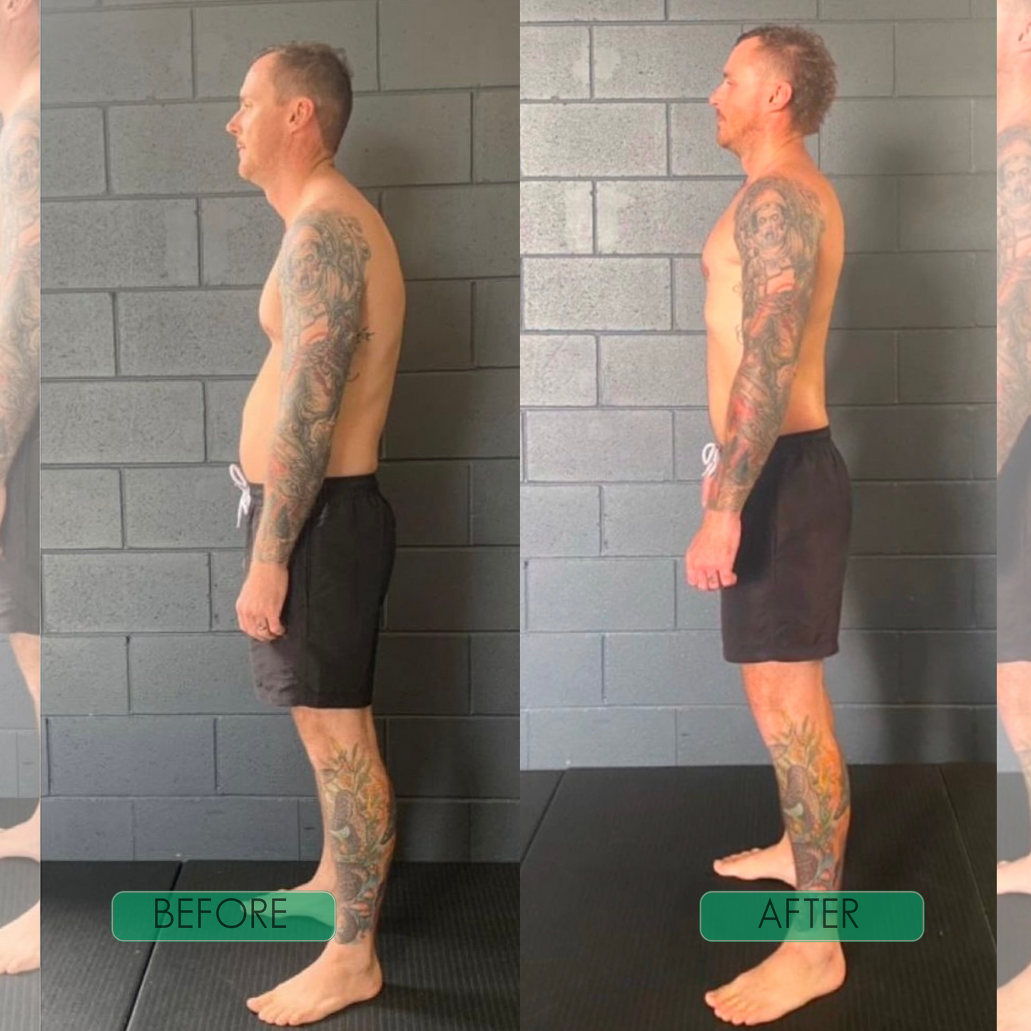 PosturePro™ Back Support Corrector