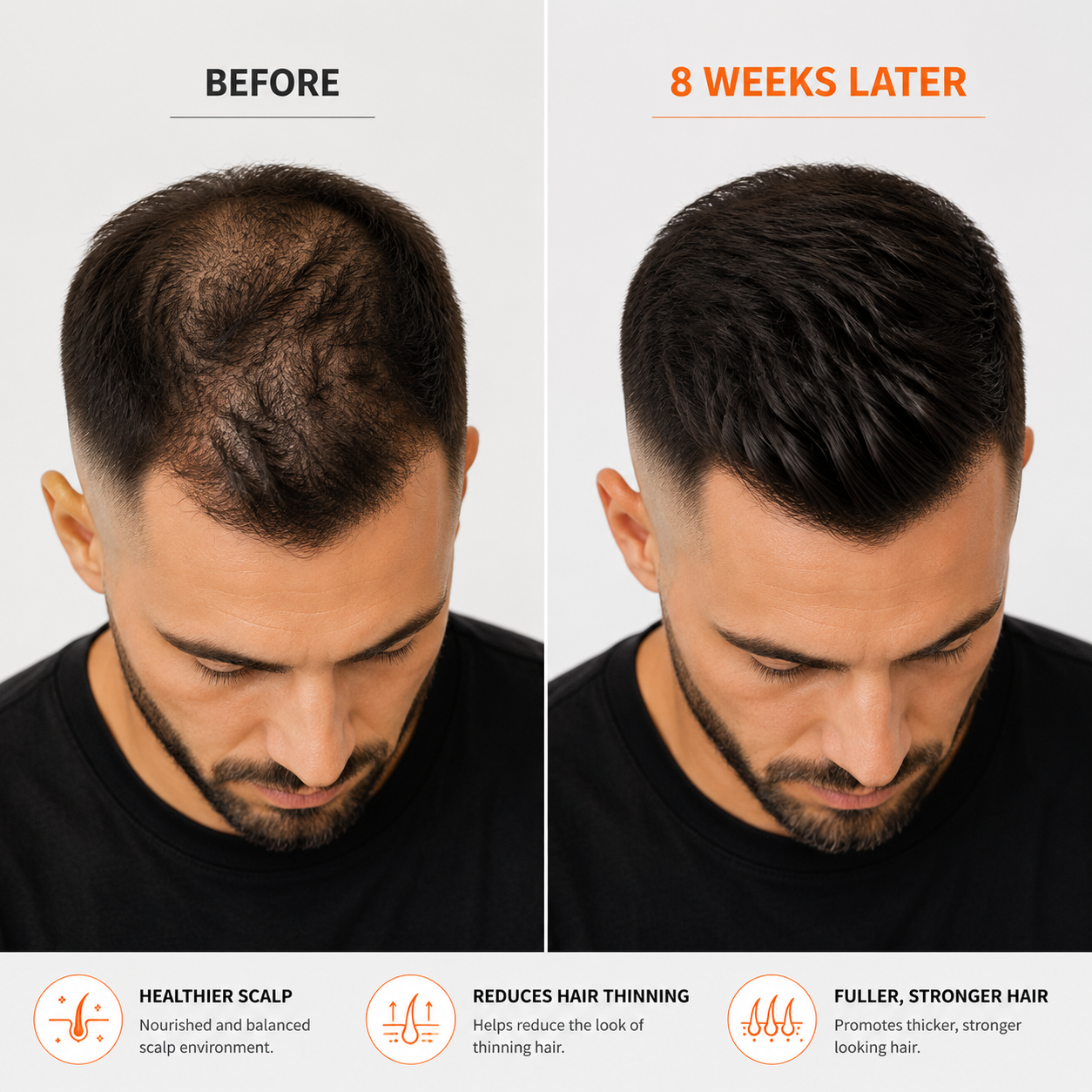 RootRevive™ Scalp Care Treatment