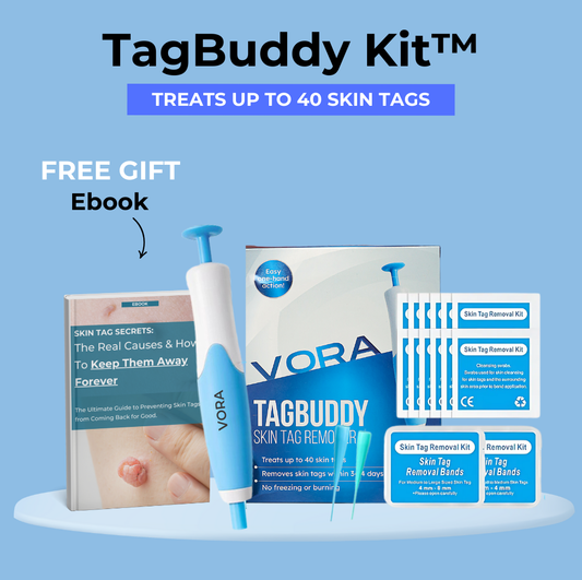 ClearTag™ Skin Tag Removal Kit