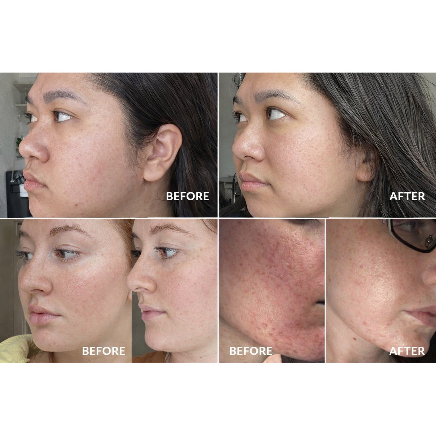 LumiClean™ Facial Cleansing System